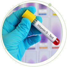 Vitamin D Analysis Made Simple