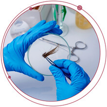 Turbocharge THC-COOH Hair Analysis with Super Sensitive LC-MS/MS and Solid Phase Extraction